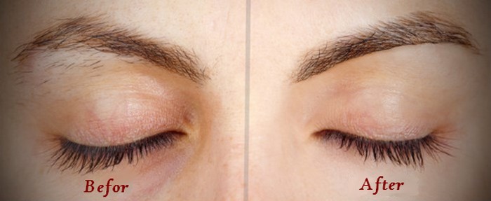 Eyebrow waxing before and after