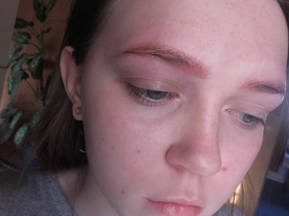 how-to-reduce-swelling-by-eyebrow